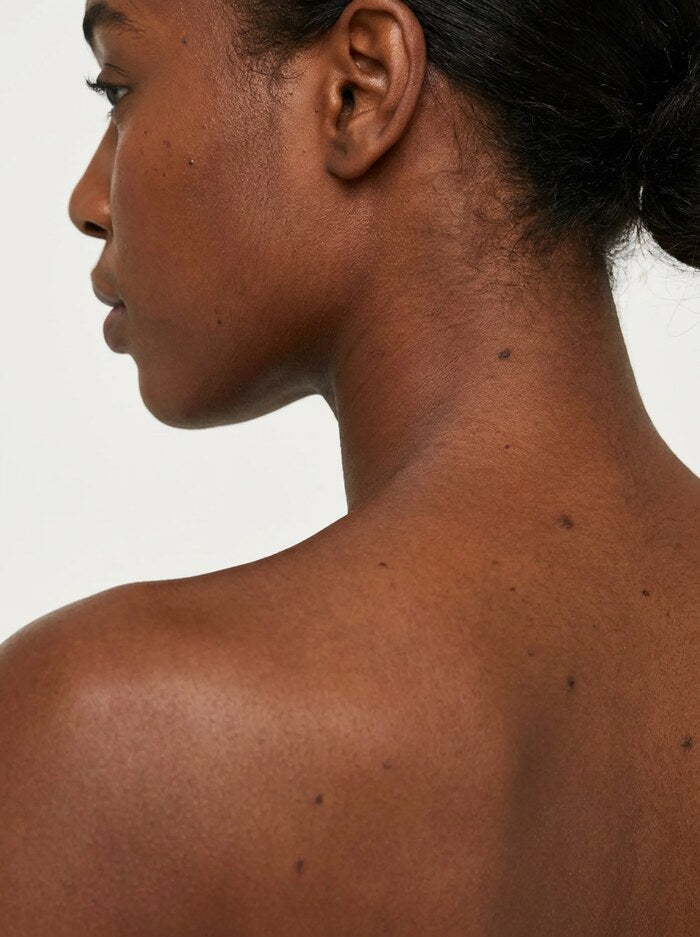 Close-up of a neck and shoulder